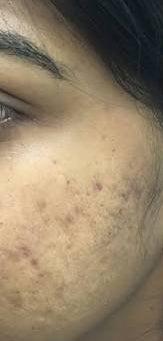 Before image