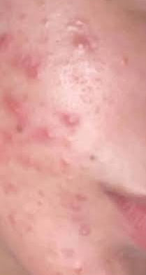 Before image