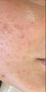 After image